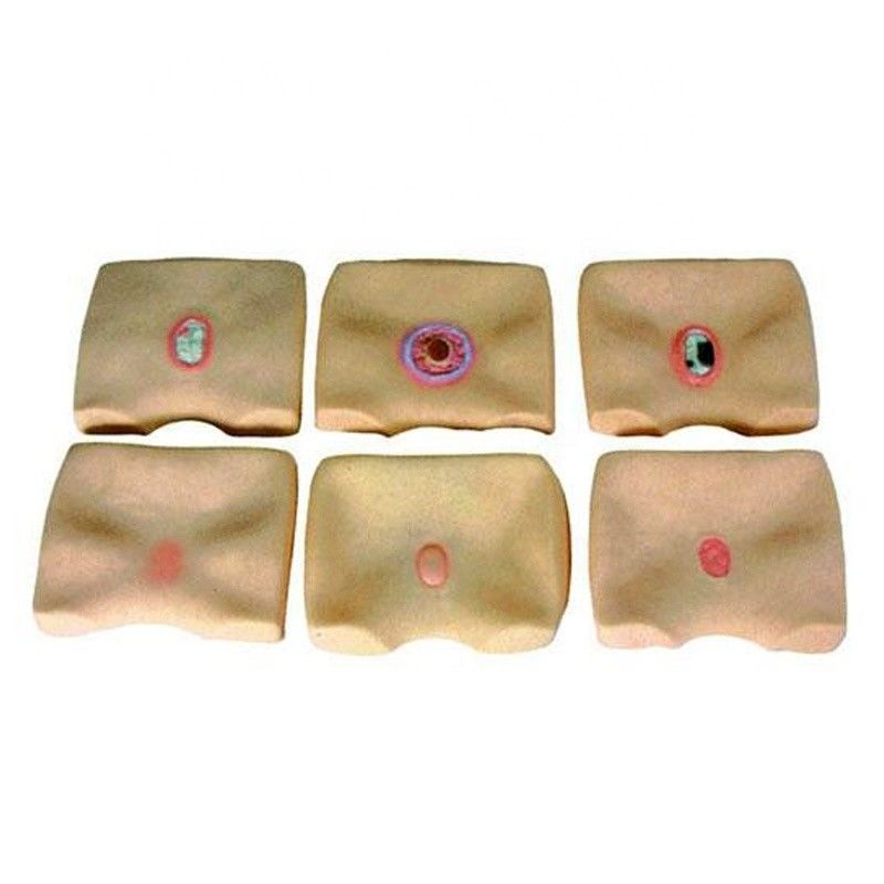 Buttock Skin Decubitus Ulcers Simulator for Hospitals Improve Bedsore Nursing Training
